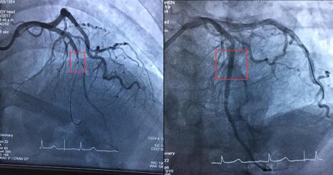 QQ截图20170110140232