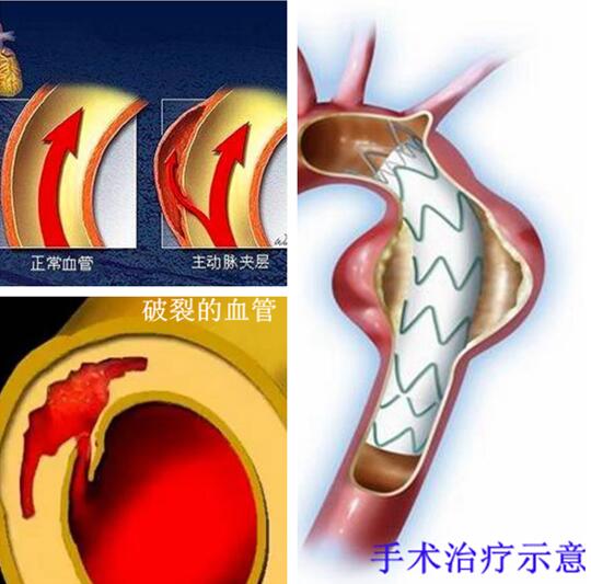 QQ截图20170309090924