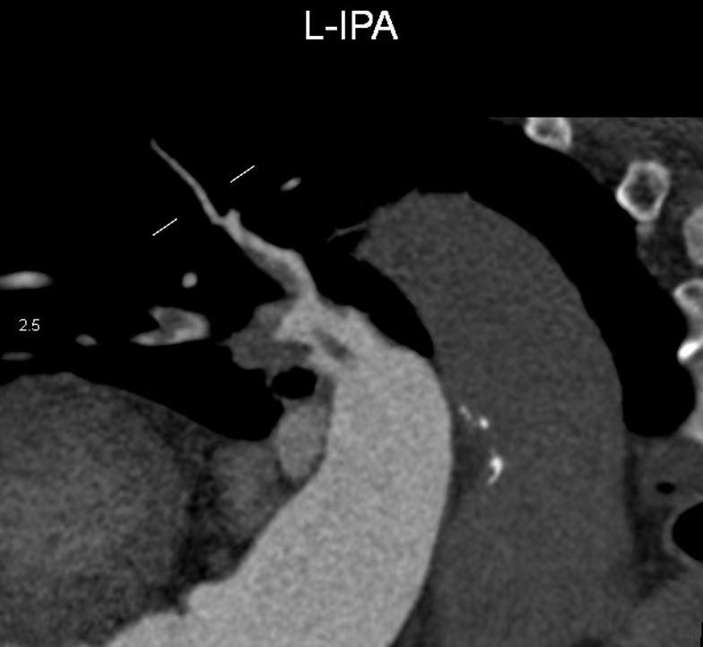 2b40f8705ec6f08a3e196976bf04853